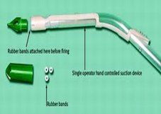 Rubber Band Ligation